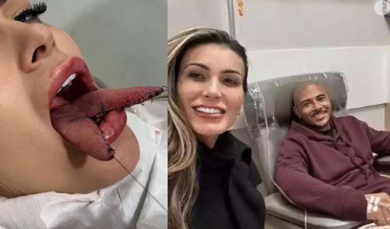 Meu Deus! Após estrear língua de cobra, namorado de Andressa urach vai parar na emergência. Saiba o que aconteceu!.